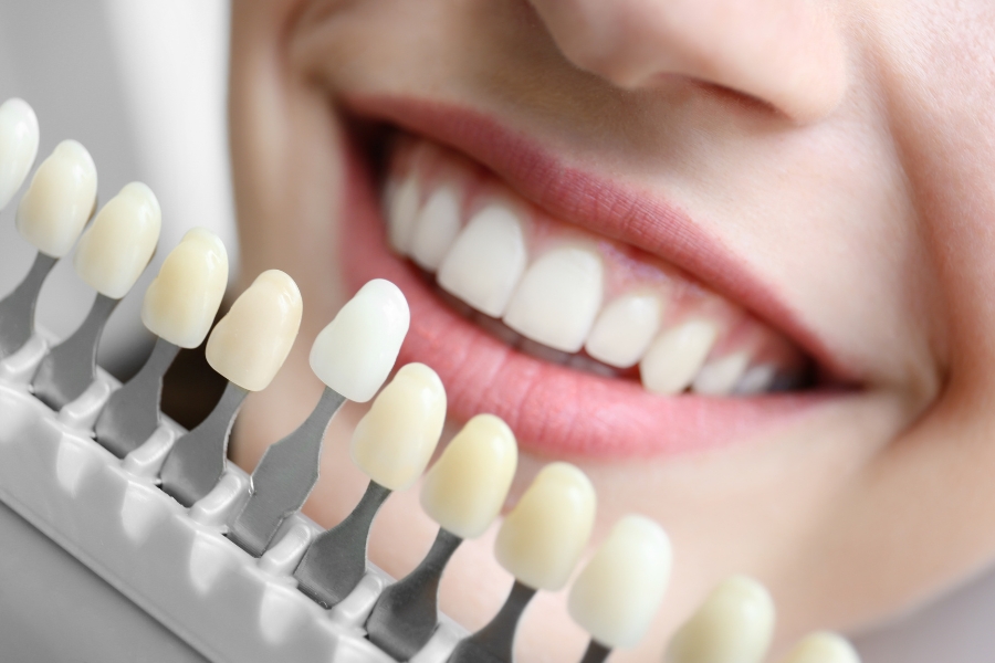 Estética Dental